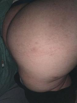 huesoroto picture