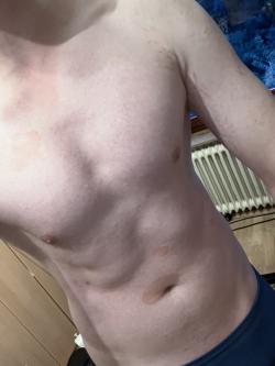 frott04